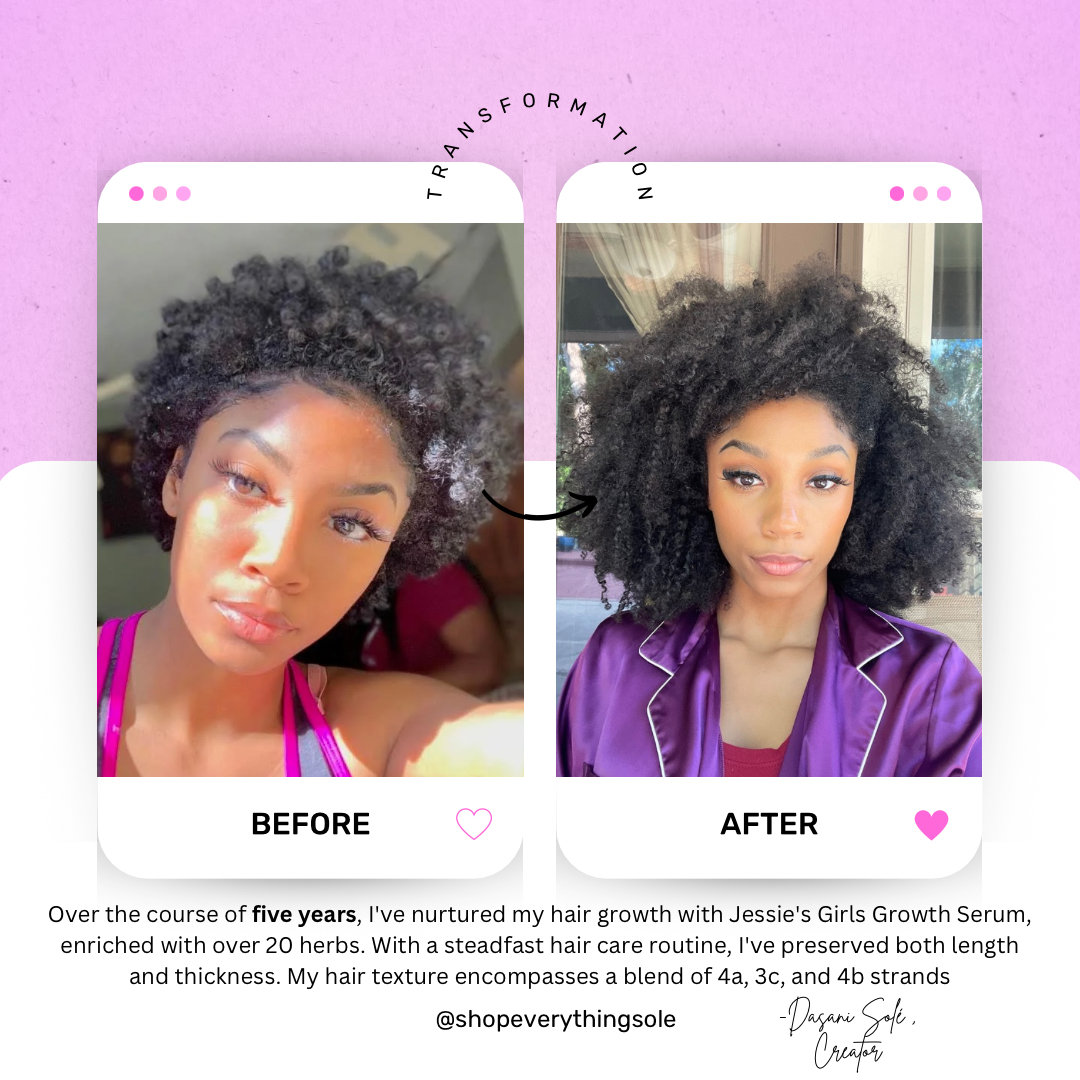 Jessie’s Girls Hair Growth Serum (Over 20+ Hair Growing Herbs)