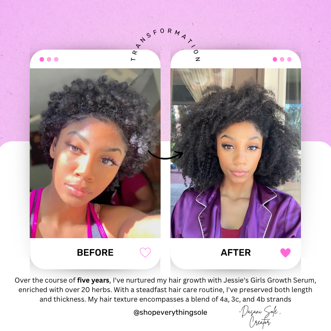 Jessie’s Girls Herbal Hair Growth Serum – 20+ Potent Botanicals