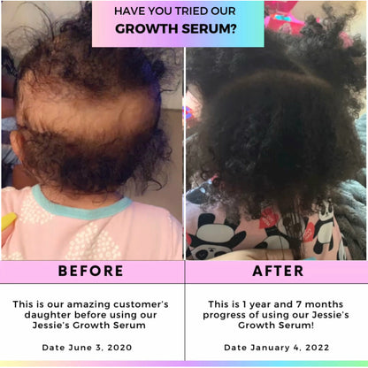 Jessie’s Girls Growth Serum - Everything Solé